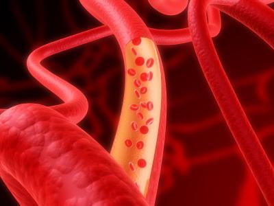 how to strengthen blood vessels