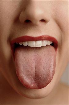 白舌症状