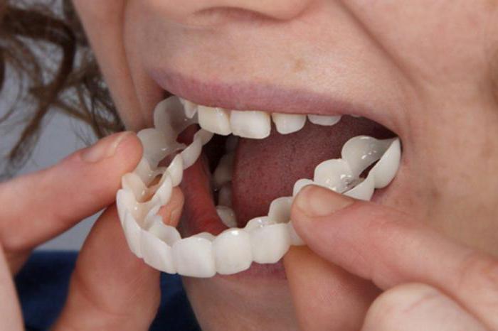 prótesis dentales acri fritas defectos