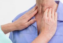 Schilddrüsenunterfunktion: Behandlung und Symptome