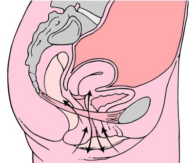 Kegel exercises when prolapse of the uterus
