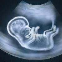 in what period an ultrasound detects pregnancy
