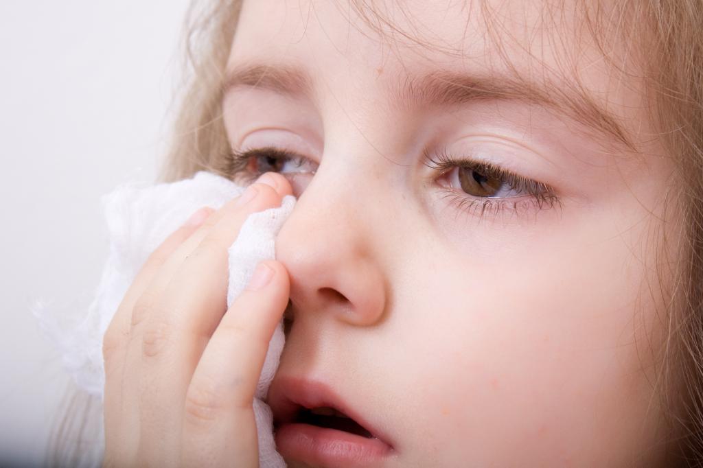 एलर्जी की प्रतिक्रिया में एक बच्चे