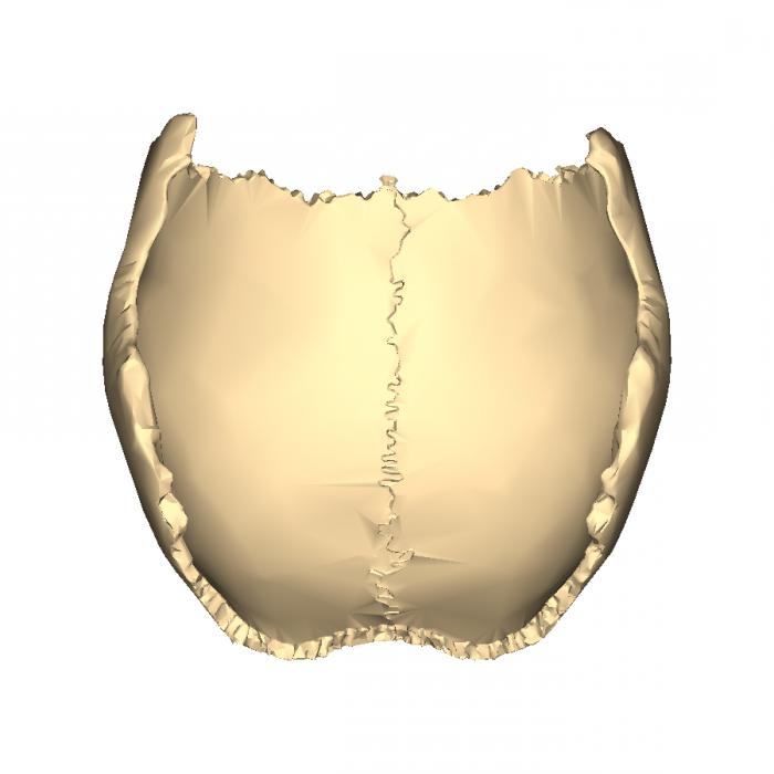 frontal ve paryetal kemik