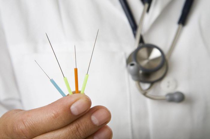 needles for acupuncture