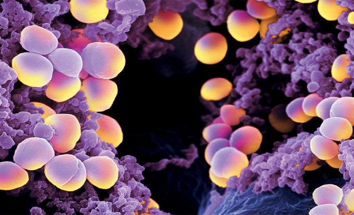 黄色ブドウ球菌の病原性細菌性乳房炎の
