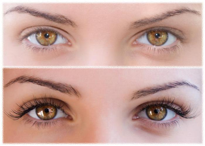 FEG für das Wachstum der Wimpern: Bewertungen Augenärzte