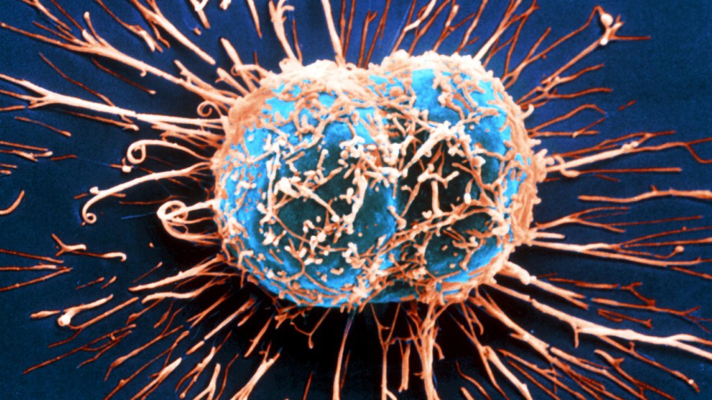 癌細胞の顕微鏡