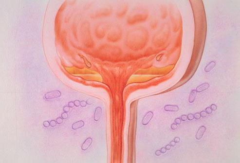 monural cystitis efficacy and reviews about drug