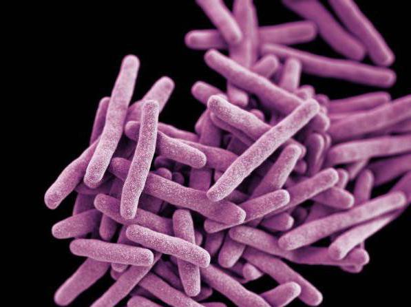 як визначити туберкульоз у дитини