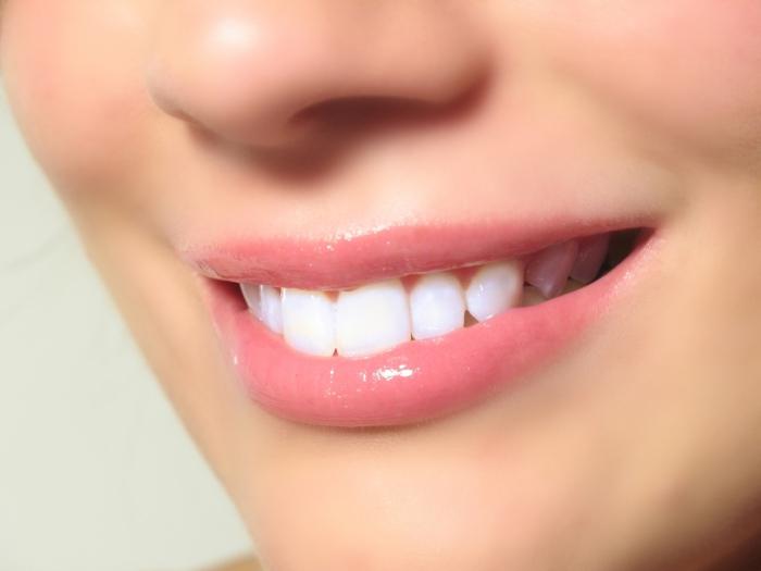 teeth whitening reviews