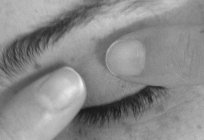 Eye pressure: symptoms, diagnosis, treatment and prevention