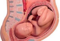 Wie Sie selbst bestimmen die Position des Babys im Bauch: Methoden der Diagnostik der Körperhaltung des Babys