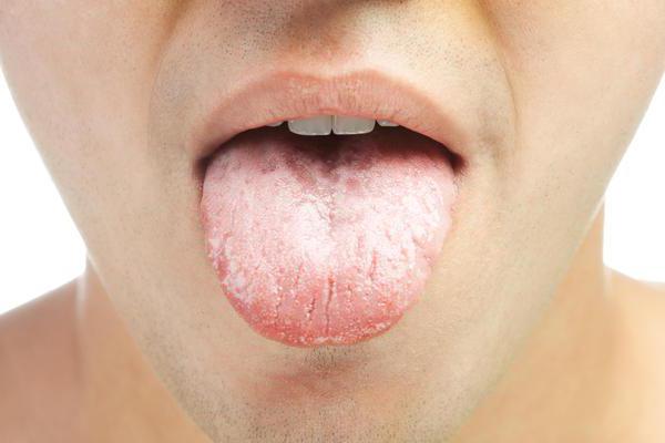 Swollen tongue: causes