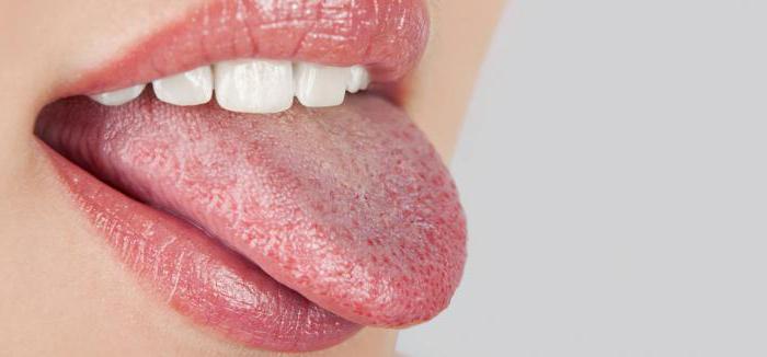 ふ舌の歯のマークは、処理