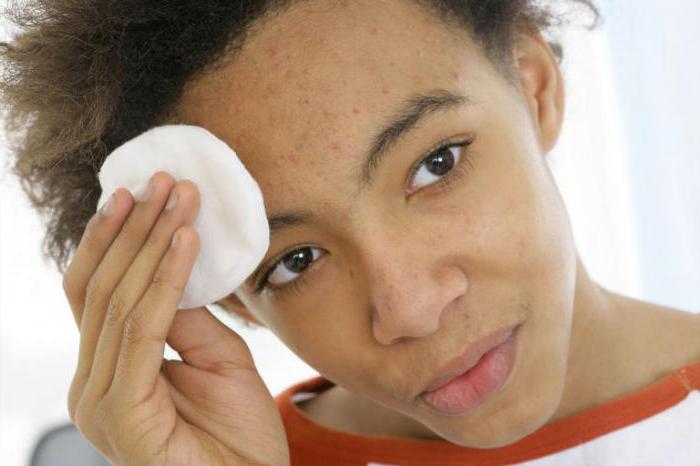 what helps acne on the face