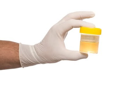 geral de análise de urina como montar um