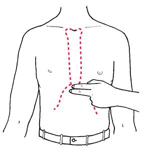 sore xiphoid process of the sternum
