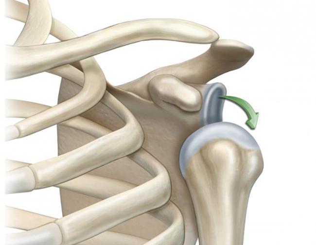 luxación de la articulación del hombro rehabilitación