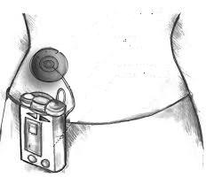 insülin pompası Veo
