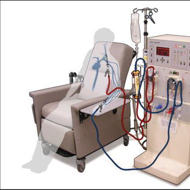 围产期的透析