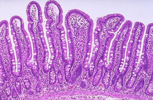 the intestinal villi in the digestive canal