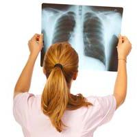 die Behandlung von Lungen-Rippenfellentzündung