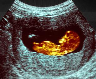 fetometry of the fetus in weeks