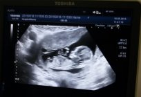 13 semana de gravidez: os detalhes