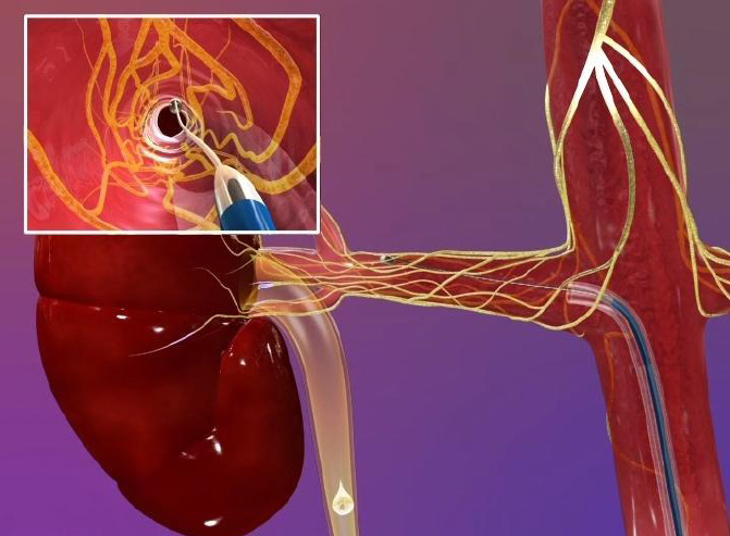 blood flow to the kidney