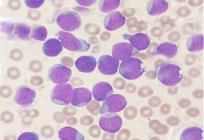 Como aumentar os glóbulos brancos após a quimioterapia