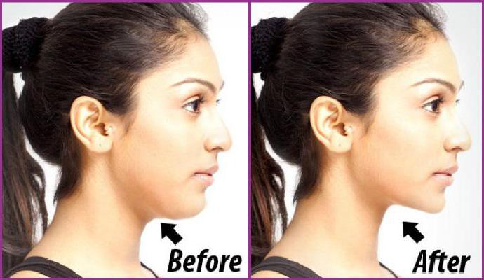 exercises to strengthen the muscles of the face and neck