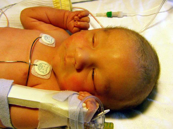 jaundice in newborns bilirubin norm table