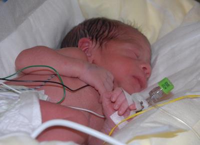 día internacional de los bebés prematuros
