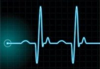 血压和脉的一个人-什么被认为是规范？