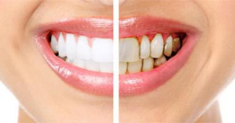 die Krankheit der Zähne und des Zahnfleisches