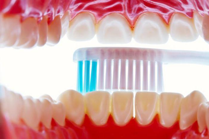 die Symptome der Krankheiten des Zahnfleisches