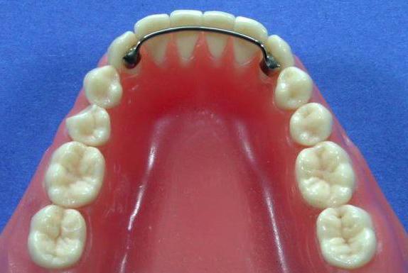 the alignment of the teeth braces