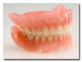 Nylon dentures