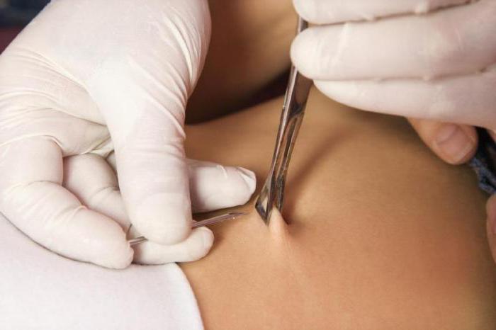 how to pierce navel at home