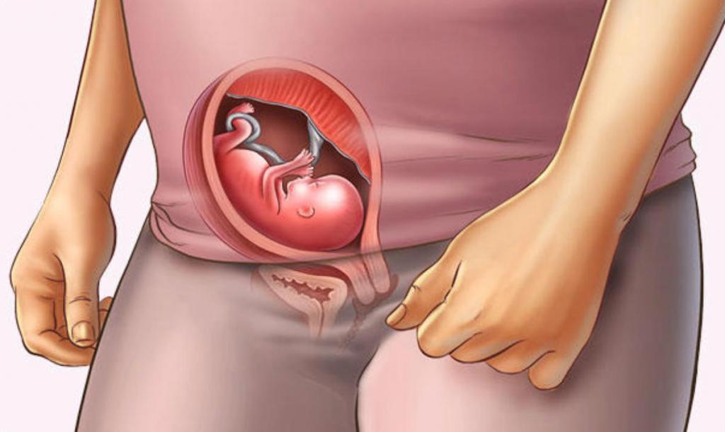 Child at 20 weeks of pregnancy