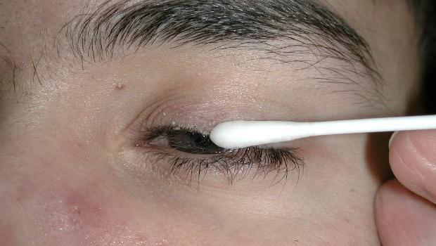 ways to treat internal stye on the lower eyelid