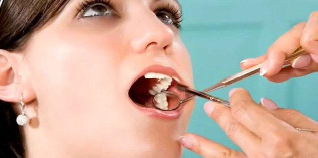die Behandlung nach der Entfernung der Zyste zahn