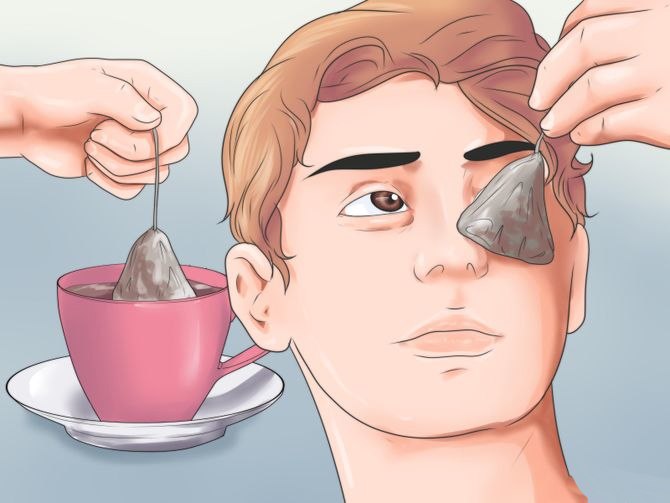 How to get rid of bags under the eyes of a man