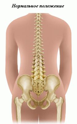laterales de la curvatura de la columna vertebral se denominan
