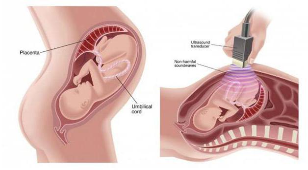 4Д la ecografía durante el embarazo