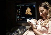 Ultra-sonografia 4D durante a gravidez: os resultados, fotos, comentários