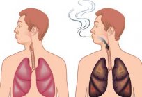 Ursachen und Symptome von Emphysem