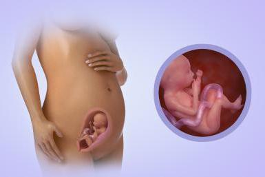 breech presentation of the fetus at 21 weeks