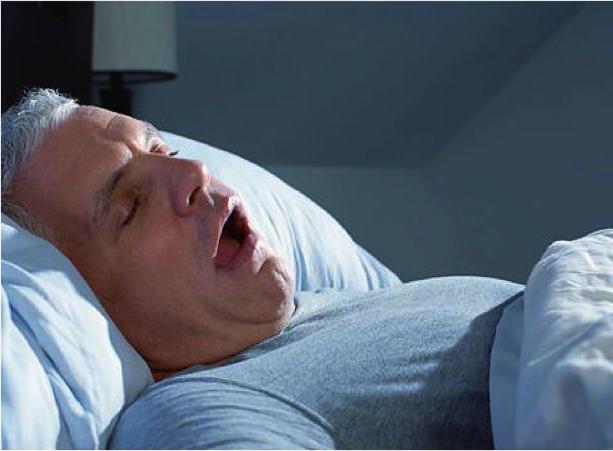 Syndrome Ondine's curse syndrome sleep apnea